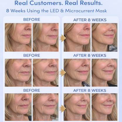 ECHOA LED Skin Mask™