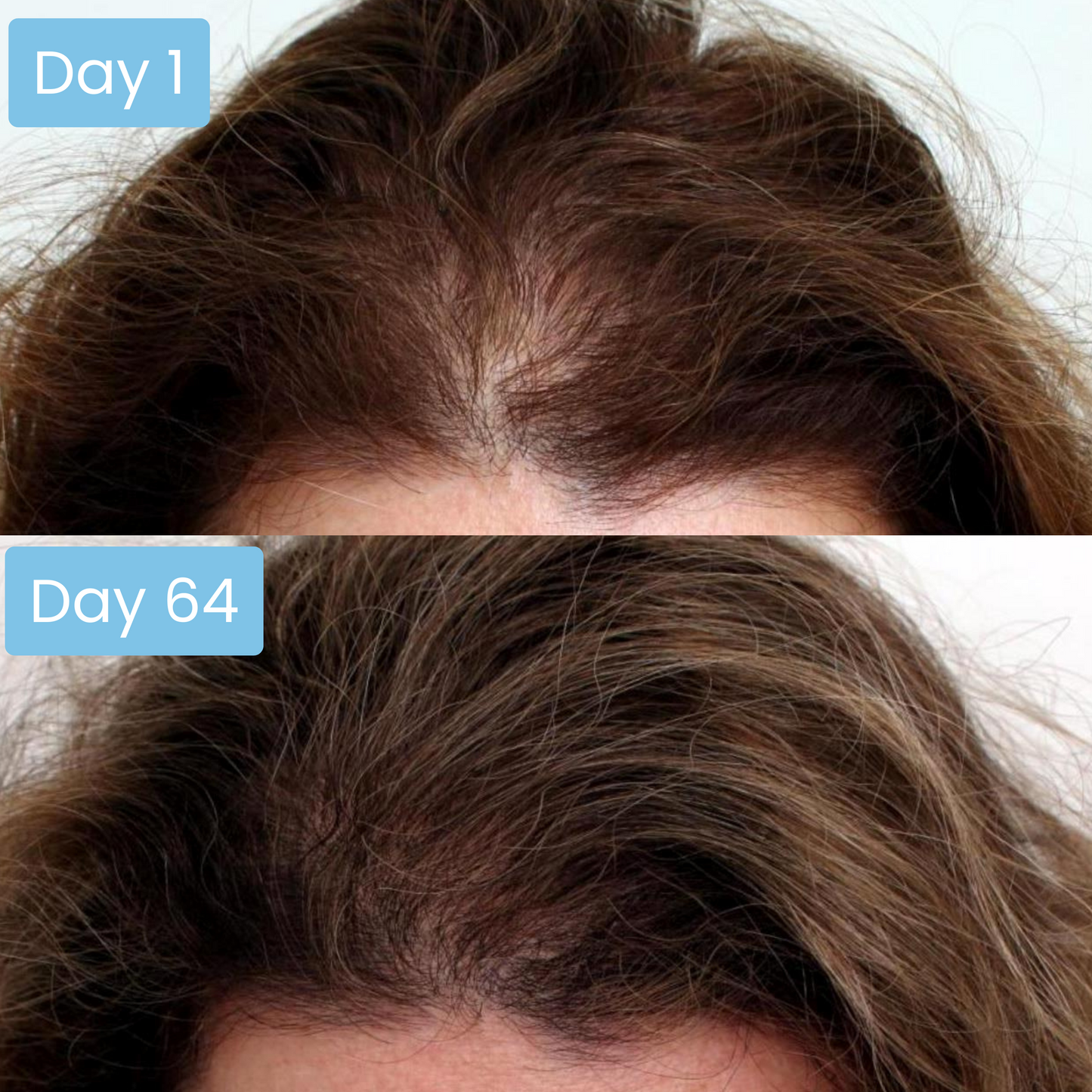 Scalpy® Hair Growth Ampoule