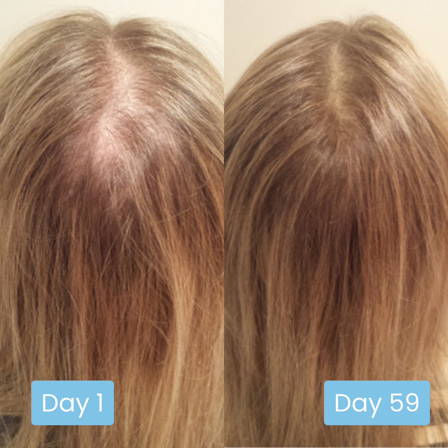 Scalpy® Hair Growth Ampoule