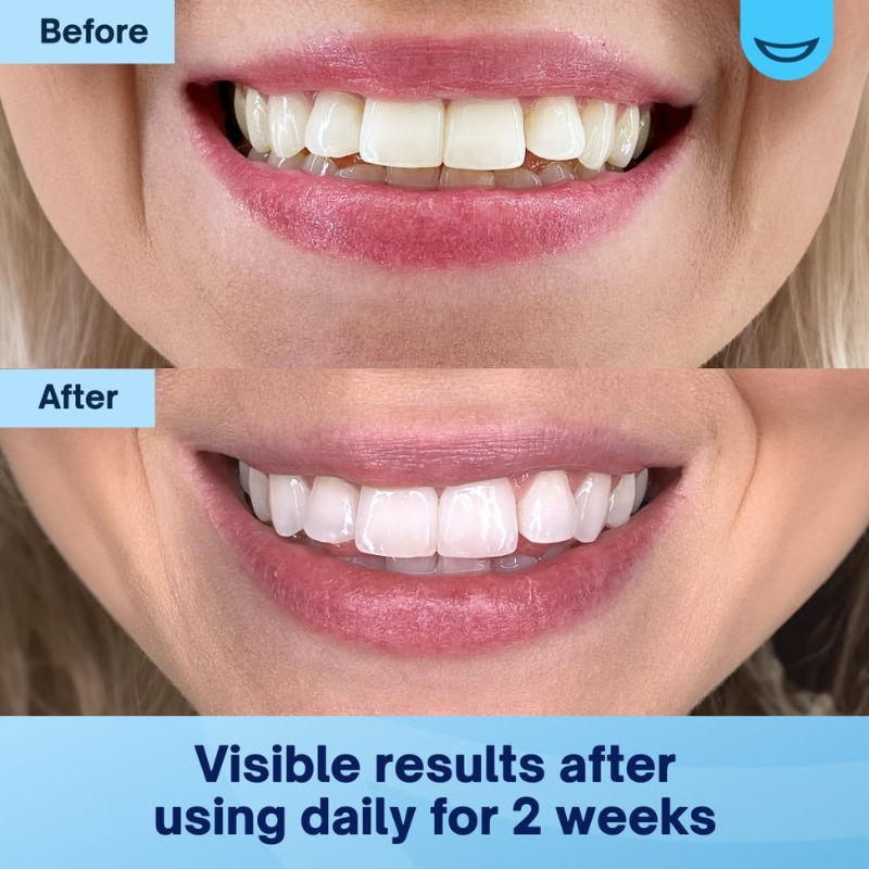 Echoa™ Teeth Whitening Powder - Buy 1, Get 1 Free